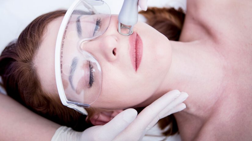 Top 8 Things You Need to Know About Laser Treatment